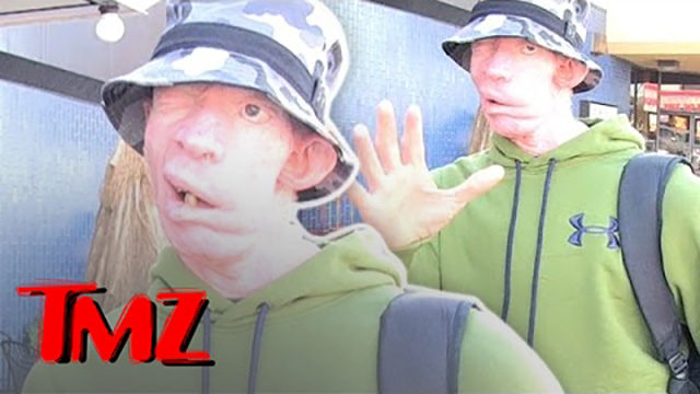 TMZ is Impressed With Reggae Star Yellowman! [4/27/2015]