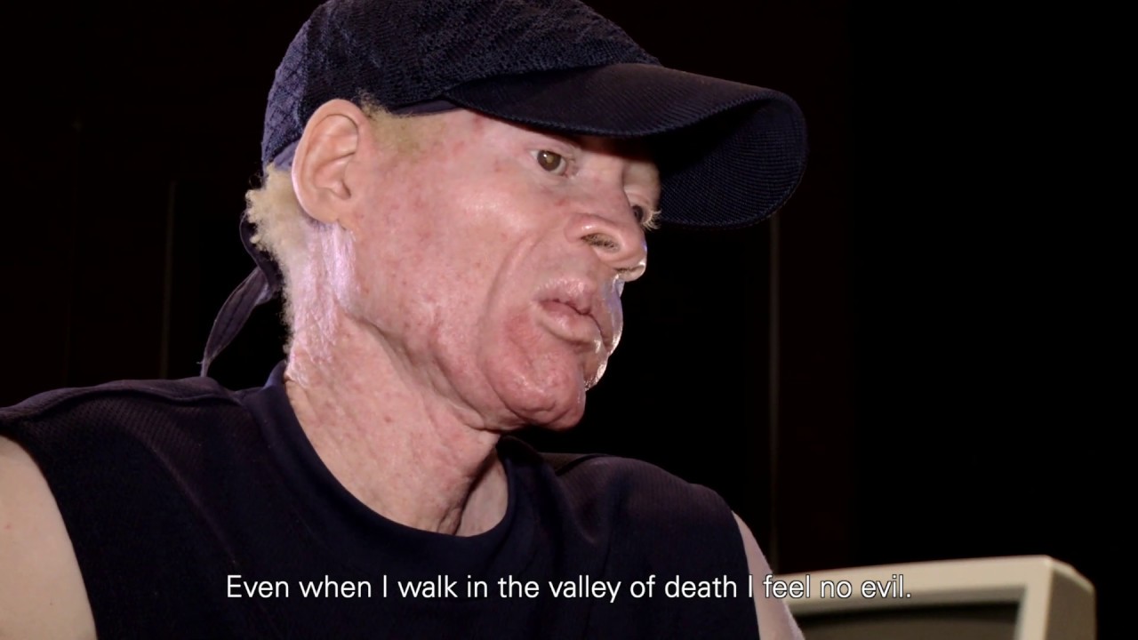 Yellowman - One King (Documentary) [2009]
