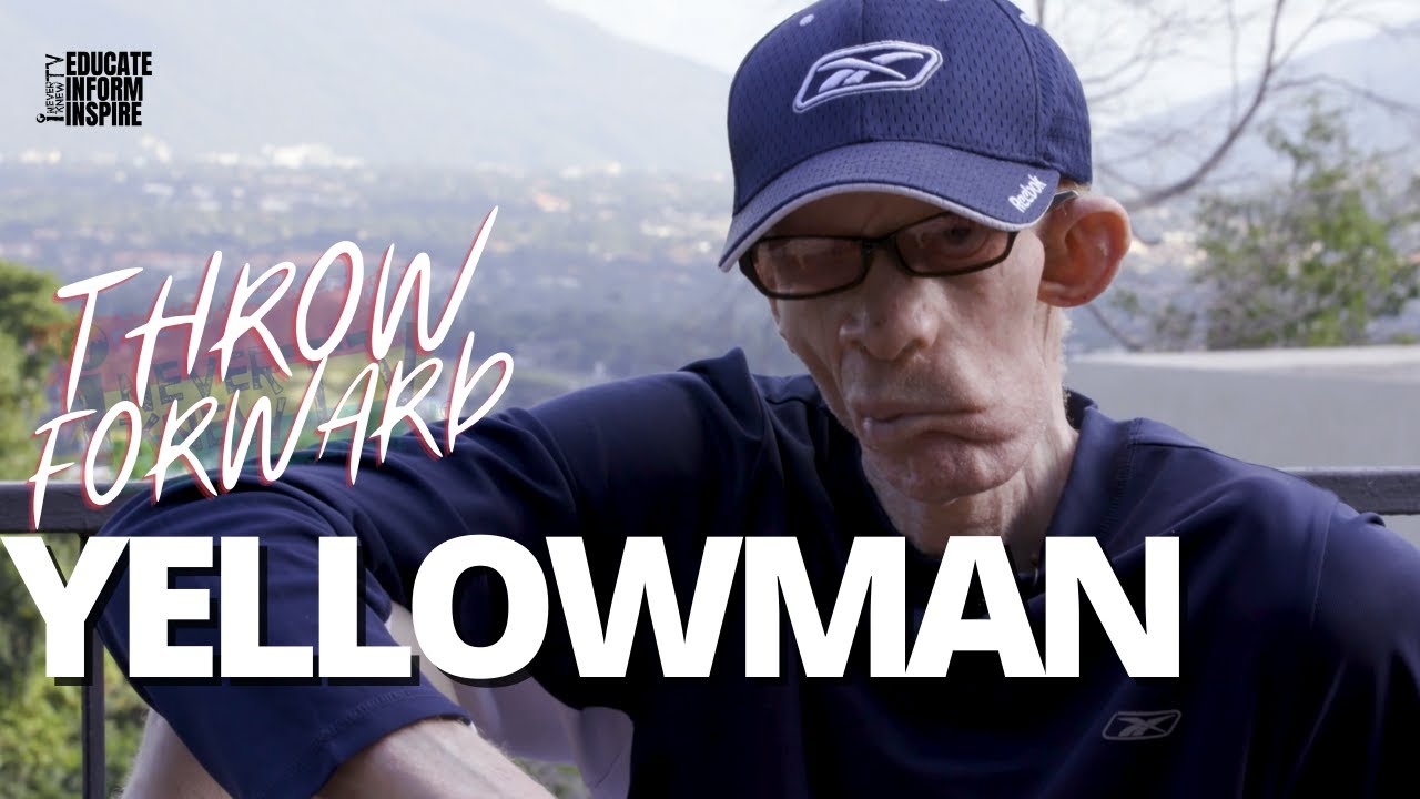 Yellowman Opens Up About Discrimination He Received And Still Receives In His Home Country (INKTV) [10/2/2022]